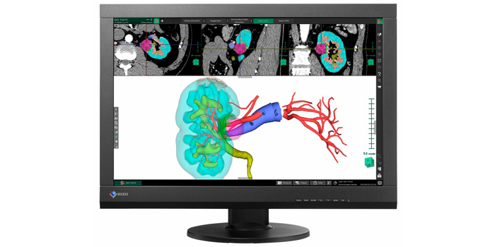 Monitor_max242w-max